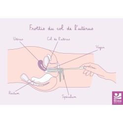 Carte anatomique Frottis du...
