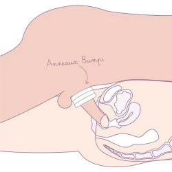 Anneau Bumpi/Backup de démonstration