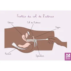 schéma anatomique du frottis peau foncée