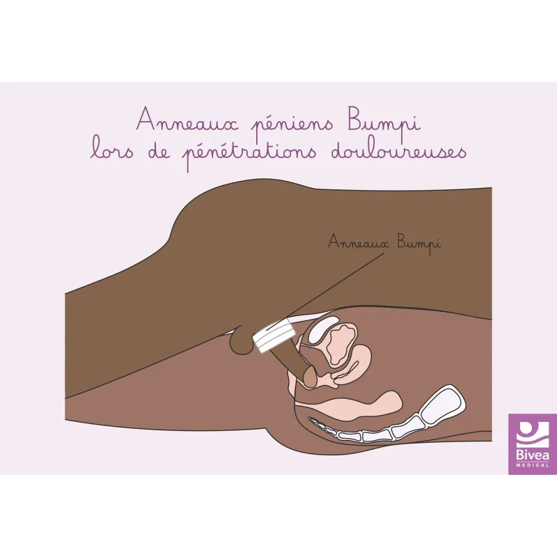 schéma anatomique utilisation anneaux de confort Bumpi peau foncée schéma anatomique utilisation anneaux de confort Bumpi peau foncée
