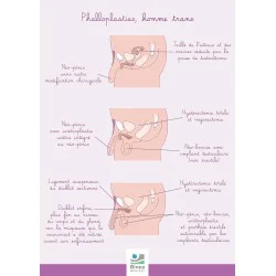 Poster A4 Phalloplasties...