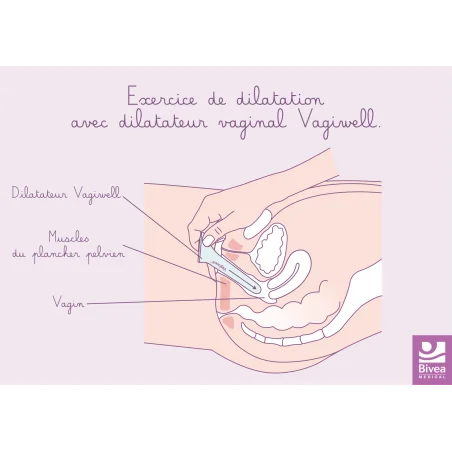 Schéma exercice de dilatation avec le dilatateur vaginal Vagiwell