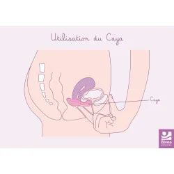 Schéma représentant l'utilisation du diaphragme Caya