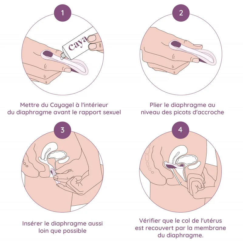 Diaphragme Caya de démonstration