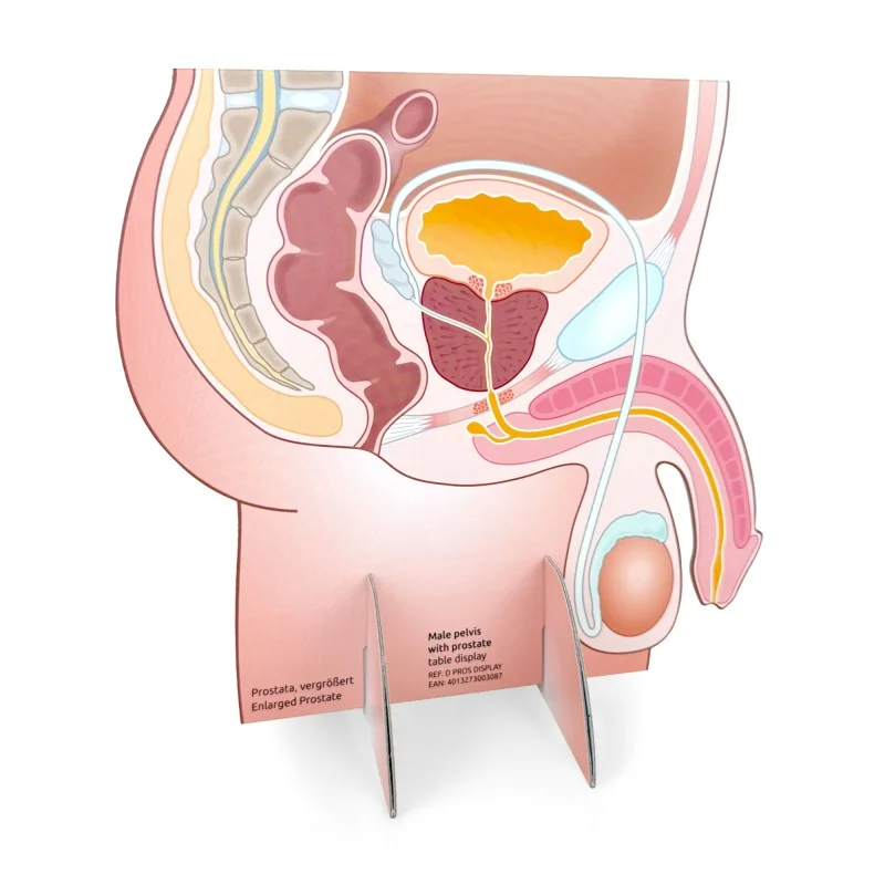 Représentation du bassin masculin avec prostate normale et grosse en carton