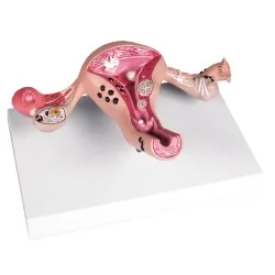 Modèle d'utérus avec...