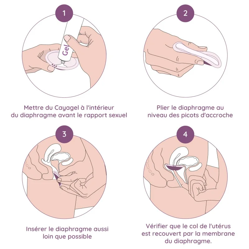 Diaphragme Singa de démonstration Diaphragme Singa de démonstration