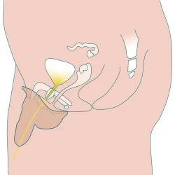 Stand to Pee packer 3 - non circoncis de Démonstration