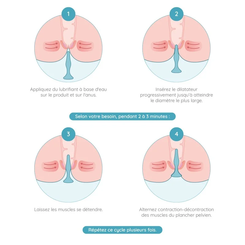 utilisation dilatateur anal
