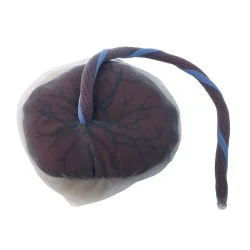 Modèle de placenta avec...