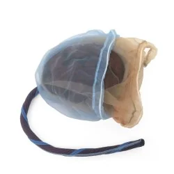 Modèle de placenta avec...