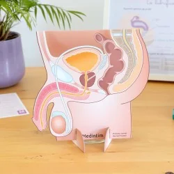 Représentation du bassin masculin avec prostate normale et grosse en carton