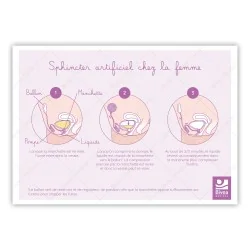 Schéma d'un sphincter artificiel chez l'homme et la femme