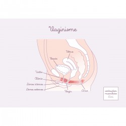 Carte anatomique Vaginisme