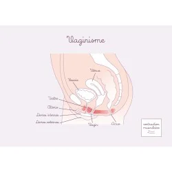 Carte anatomique Vaginisme