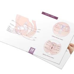 Poster A4 Moyens de Contraception